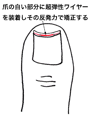 Nailwire.gif