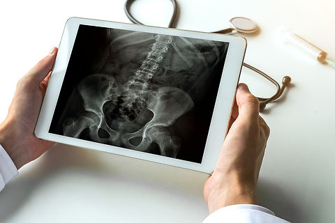 bigstock-Doctor-Watching-A-X-ray-Of-Hip-241959700.jpg
