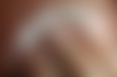 Four skintastic reasons to get a chemical peel TODAY!