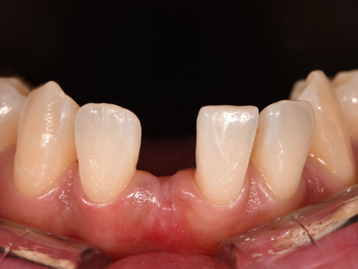 STM No-Prep Maryland Bridge #41