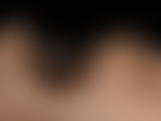 STM Implant Crown #47