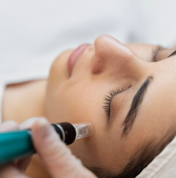 MNRF Skin Treatment in Mumbai.jpeg
