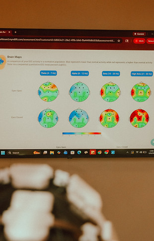 Colorful qEEG brain maps on screen for neurofeedback