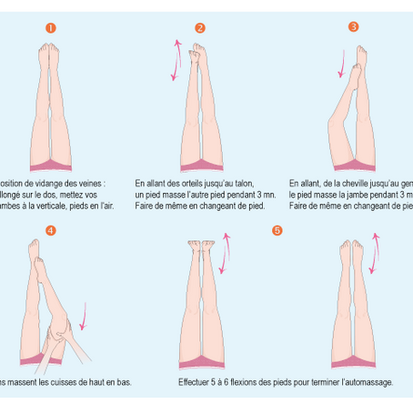 Conseils pour lutter contre le syndrome de congestion pelvienne