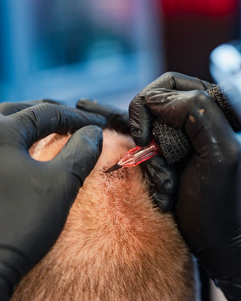 Foto scalp website.jpg