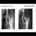 hip dysplasia graphic