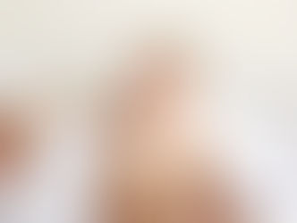 Refluxo gastroesofágico no bebê