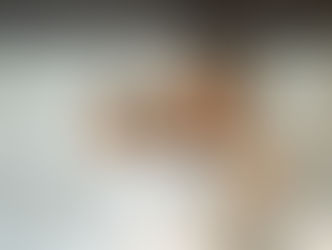 Insônia por estimulantes