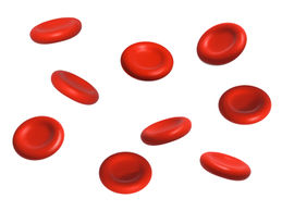 Anemia aplástica