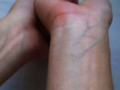 sangue das veias parece azul