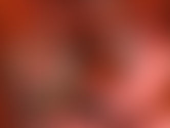 Nódulos Hepáticos Benignos