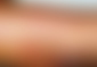 Larva migrans cutânea