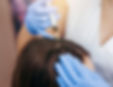 Medical professional injecting serum into a patient's scalp, hair treatment, close-up view.