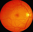 retina_edited.jpg