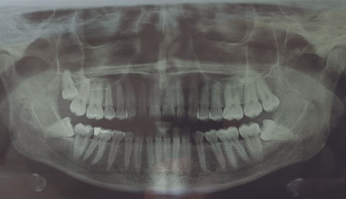 панорамна снимка на ретиниран мъдрец