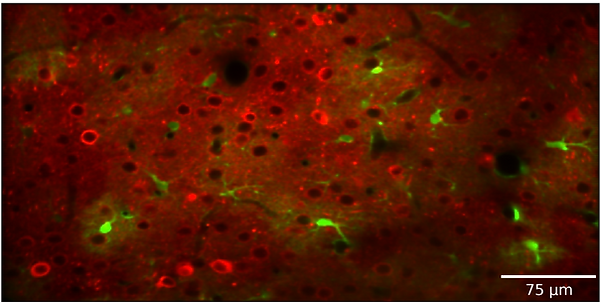 neuron-astrocyte dual channel 2_edited.p