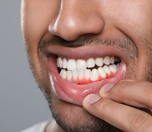 Family Dentist in St. Charles Parish, LA