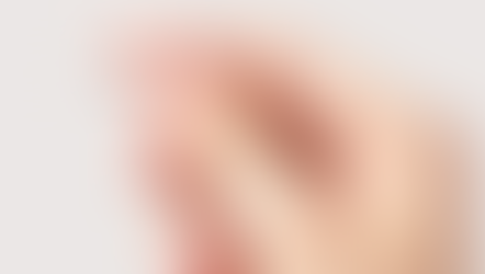 Implantes hormonais: Especialista esclarece a polêmica em torno dos 'chips da beleza'