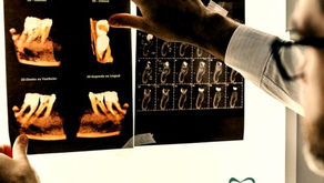 Mobilidade dental: saiba mais