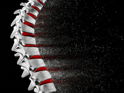 Ayurveda approach to osteoporosis prevention and bone health through natural lifestyle and metabolism balance.