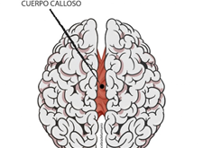EL CUERPO CALLOSO 🧠