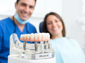 all-on-4 implants in Shanghai