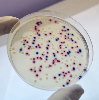 Koliform, Fekal Koliform ve E.coli Analizi