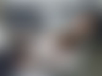 Female patient receiving nitrous oxide sedation.