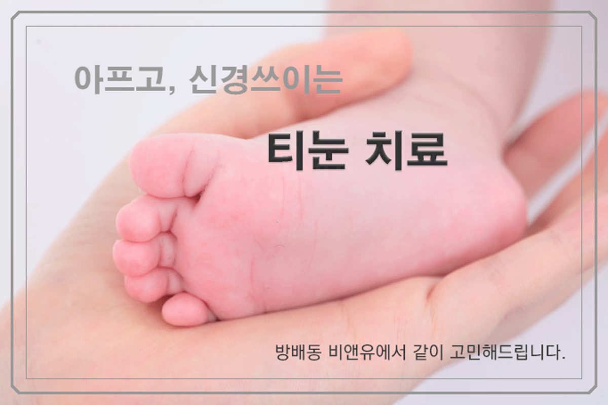 방배 피부질환 티눈