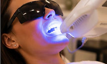 TeethWhitening_edited.jpg