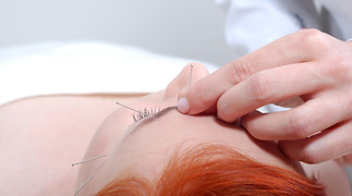 Portrait of a beautiful woman in acupuncture therapy.jpg