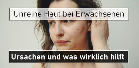 unreine haut bei erwachsenen