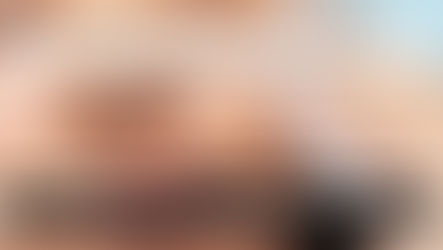 große poren harzsalbe