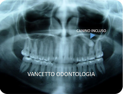 CANINO INCLUSO.jpg