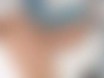 Volite Fillers in Dubai