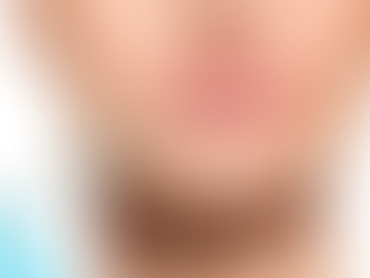 How Can Lip Fillers Improve the Symmetry of Your Lips?