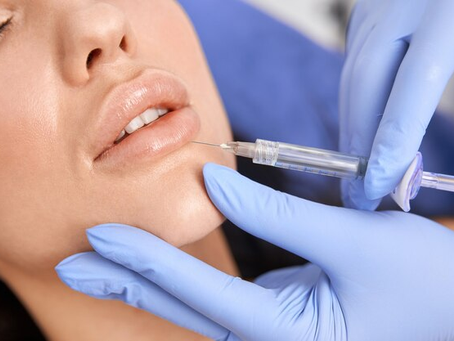 Russian Lip Filler in Dubai
