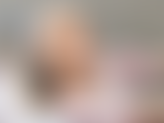 Volite Fillers in Dubai