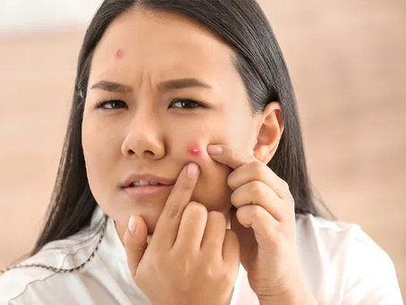 Best Pimples Treatment in Dubai