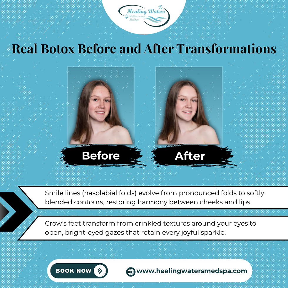 Real Botox Before and After Transformations