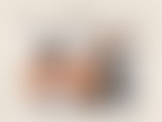 Lip Filler in Dallas, TX | Shape, Technique & Precision