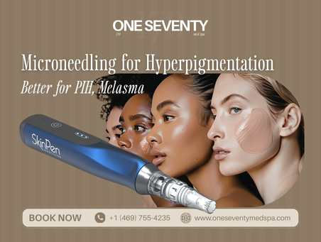Microneedling for Hyperpigmentation in Dallas, TX | Better for PIH, Melasma