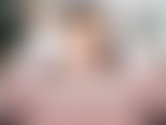IPL Photofacial Results in Little Elm, TX: Visible Skin Transformation