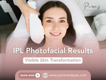 IPL Photofacial Results in Little Elm, TX: Visible Skin Transformation