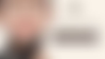 Lip Filler Cost in Dallas, TX: Real Pricing & Results