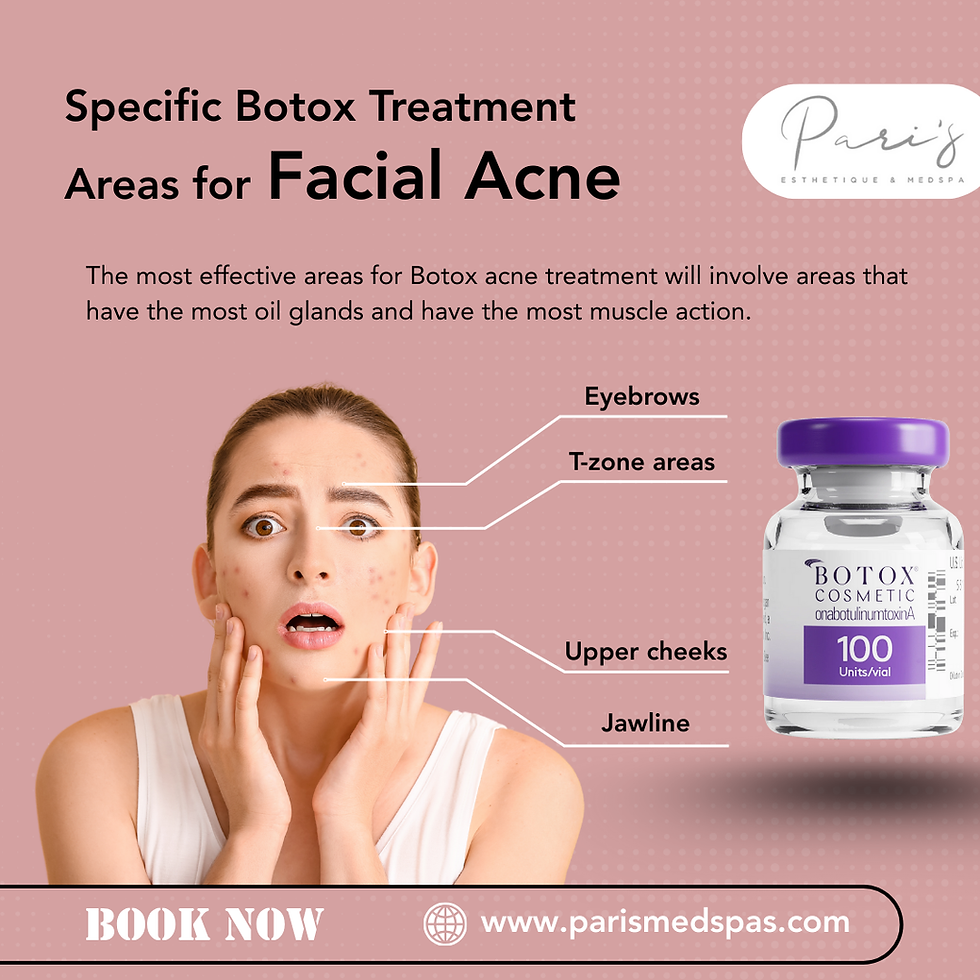 Specific Treatment Areas for Facial Acne