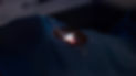 trans-pkr-yeux-laser-strasbourg.jpg