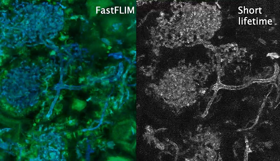 Microscope images of the fossils show the bush-like structure of the fungus’s arbuscules and the web of hyphae connecting them