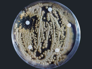 How Efficient Fat Metabolism Helps Fungi Become Human Pathogens