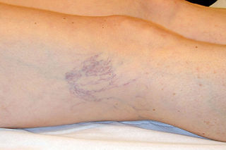 TRATTAMENTI CURA CAPILLARI